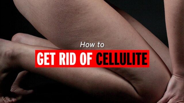 get rid of cellulite