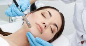 Microdermabrasion 1