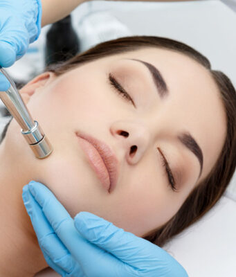 Microdermabrasion 1