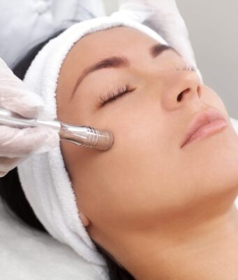 microdermabrasion