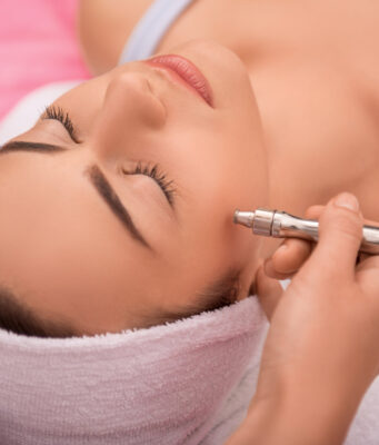 microdermabrasion 4