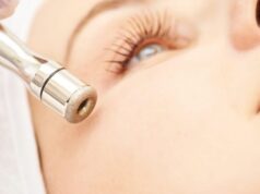 Does Microdermabrasion Treatments Work for Acne Scars – 2025 Guide microdermabrasion process