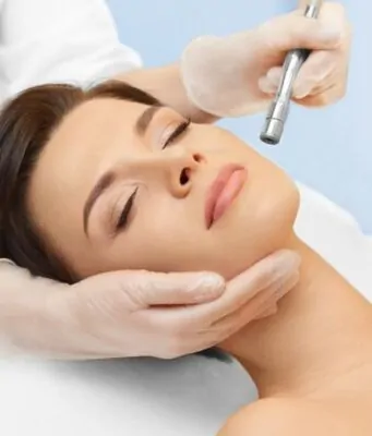 Microdermabrasion