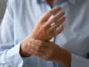 Arthritis Pain