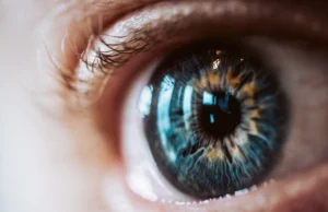 Healing Process after a Refractive Lens Replacement Surgery