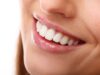 Teeth Are Perfectly Alligned