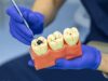 Causes of Tooth Decay