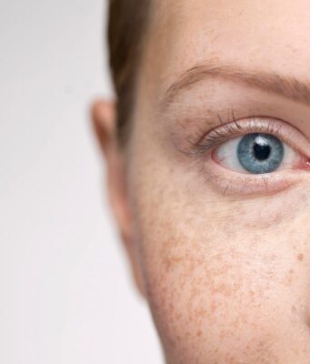 How To Reverse Sun Damaged Skin