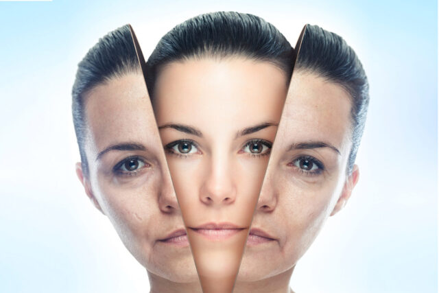 Skin Rejuvenation Exploring the Advantages of Carbon Peel