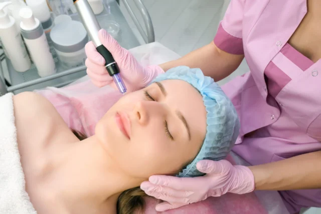 Should You Get Microneedling