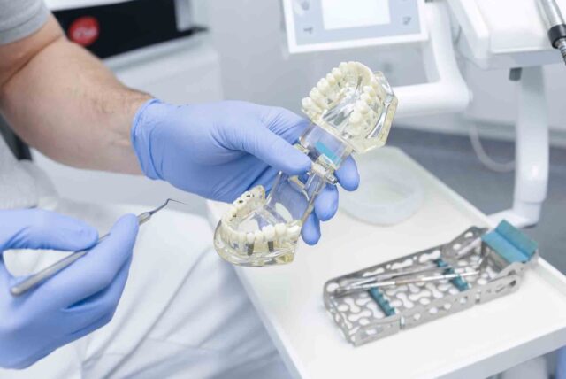 All On 4 Dental Implant Procedure All On 4 Dental Implant Procedure